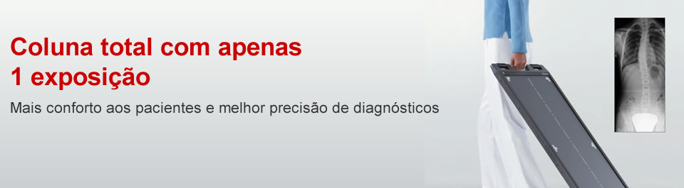 coluna-total-1-incidencia